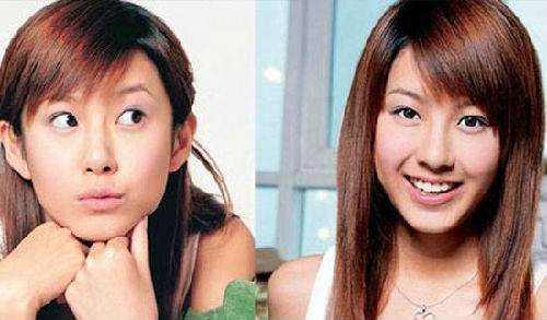 张子萱承认整容 张子萱整容前后对比照片